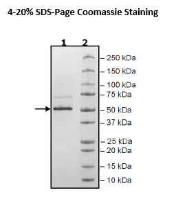 Nucleocapsid Protein (B.1.1.7 Variant), Avi-His-Tag (SARS-CoV-2)