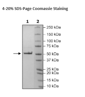 Nucleocapsid Protein (P.1 Variant), Avi-His-Tag (SARS-CoV-2)