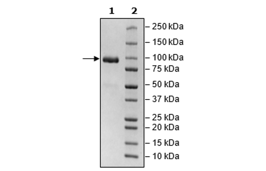 DDR2, Fc Fusion (lgG1), Avi-Tag, Biotin Labeled Recombinant