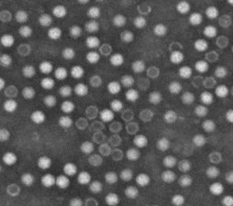 Electron microscopy characterization of AAV purity, showing the typical icosahedral particles.