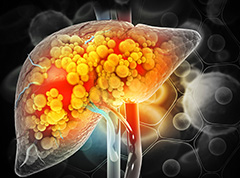 Emerging Therapeutic Concepts for MASH